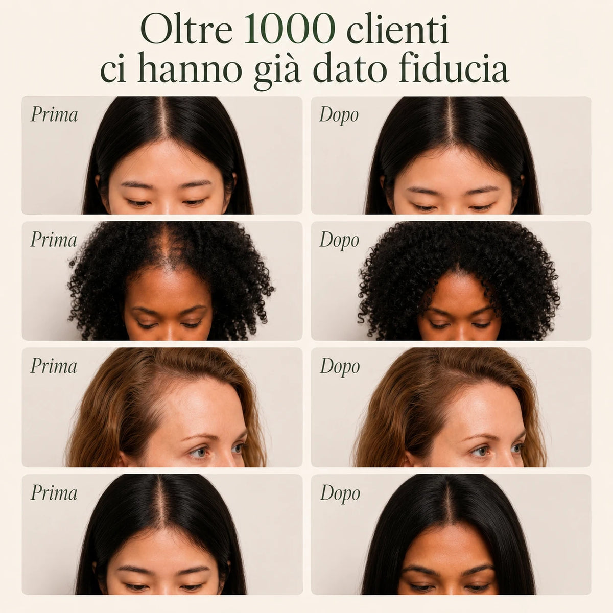 Shampoo Solido Anticaduta Coreano